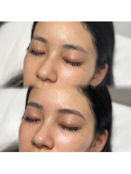 レアファースト/ハリウッドブロウリフト/HBL