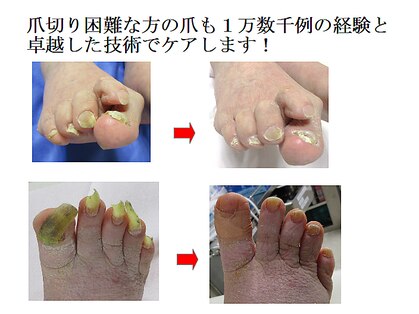 フットナース ケー(K)の写真