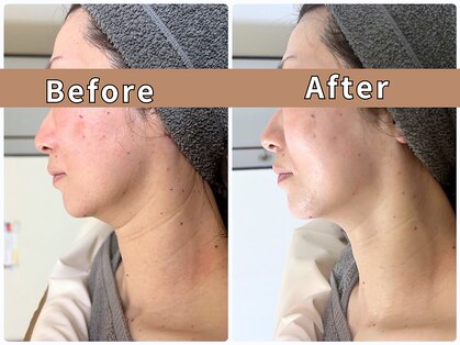 オーダーメイド痩身&小顔矯正専門店Re:Lives【リライブ】金町店の写真