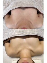 ナーチャー 久留米(Nurture)/バストアップ♪ビフォーアフター