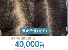 ラヴィ(Ravi)の雰囲気（プロセルセラピーズ(育毛促進)）
