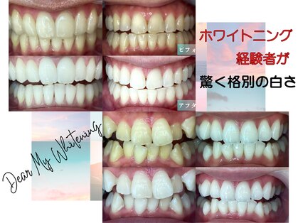 ティンクル(TWINKLE)の写真