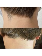 ワックスラボ(WAXLAB)/うなじWAX＋うなじ光　　W脱毛