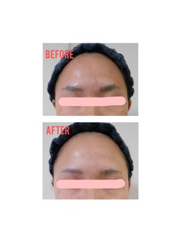 肌質改善サロン 姫路駅前店/肌質改善：クスミ.乾燥