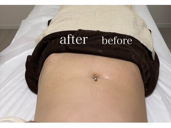 ラ セメリエ(La S'aimeriller)/経絡リンパマッサージ