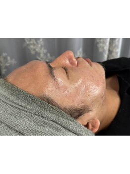 メンズフェイシャル