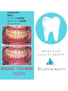 プラチナムビューティ 渋谷店(PLATINUM Beauty)/セルフホワイトニング