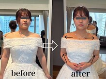 フィス エステティックサロン/ブライダルエステ