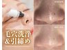 【黒ずみ毛穴+毛穴引締めケア付】毛穴洗浄×プラズマフェイシャル