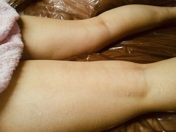 リンパマッサージエステ プルーヴ(Prove)/冷え冷えの脚に