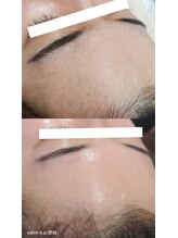 ビーピー 渋谷(b.p.)/フェイスワックス×ソフトハーブ