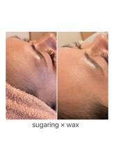 ルバート(rubato)/お顔シュガーリング×ワックス