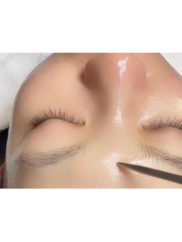 ホウレイ線・たるみ改善！予防ケア