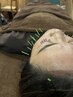 【　気になる部分を短時間ケア　】美容鍼30分