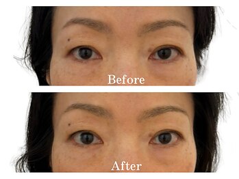 モリタ鍼灸整骨院/フェイシャル　before　after