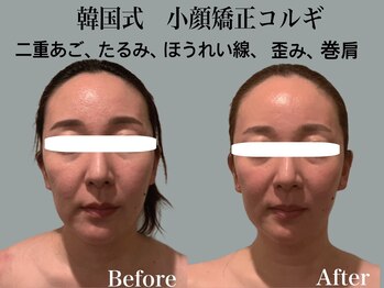 ジェイオー(J.O)/小顔矯正コルギ/リンパコルギ
