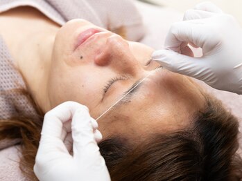 トータルメンズエステ キング(KING)/アイブロウ骨格マッピング