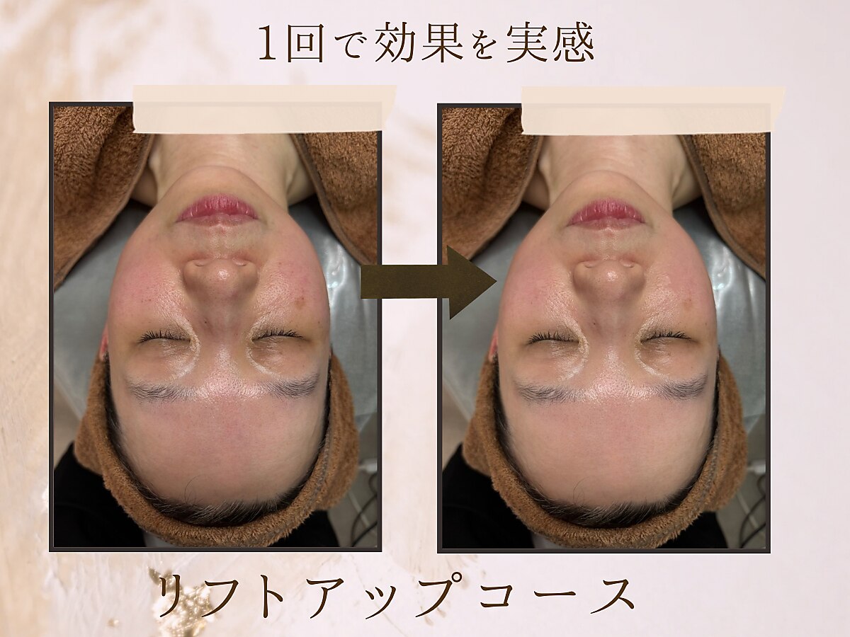 新長田駅で毛穴ケアが人気のエステサロン｜ホットペッパービューティー