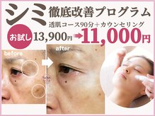 スイッチ(Switch)/50代こそシミ徹底改善で美肌へ！