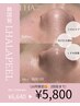 【10月限定★】脱乾燥肌！/術後すぐ体感☆低刺激ララピール ￥6640→￥5800！