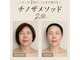 ルース(LUCE)の写真