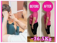 定番人気の耳ツボ体験＋ダイエットカウンセリング2980円