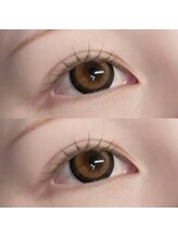 フィールリファイン(Feel Refine)/ラッシュリフト