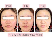 アドレル(Adorer)の雰囲気（ダイエットはしてません！ご本人も変化を実感してます♪）