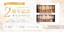 ホワイトニングショップ 札幌(Whitening Shop)