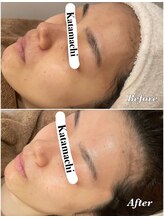 メナードフェイシャルサロン 片町店/くすみ改善♪