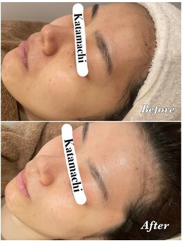 メナードフェイシャルサロン 片町店/くすみ改善♪