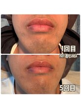 シンバ 倉敷店(SIMBA)/