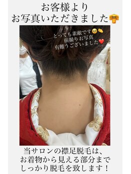 エリス(ELISSE)/前撮り前に襟足脱毛増えてます