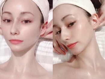 フェミニー(Feminy)の写真/個人サロン近畿エリアベスト5に認定された圧倒的技術力。輪郭矯正×高周波で骨格から小顔に！