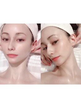 小顔になりたい