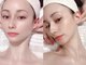 フェミニー(Feminy)の写真/個人サロン近畿エリアベスト5に認定された圧倒的技術力。輪郭矯正×高周波で骨格から小顔に！