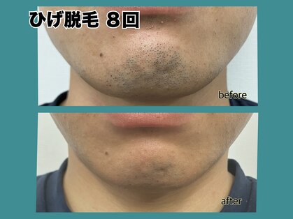 ナインズ(nines)の写真