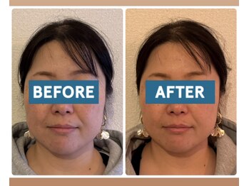 ル メルシェ(Lemerci)/初回 &nbsp;before &nbsp;after！