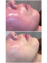 フォーユー 飯能店(Foryou)/エンビロンフェイシャル