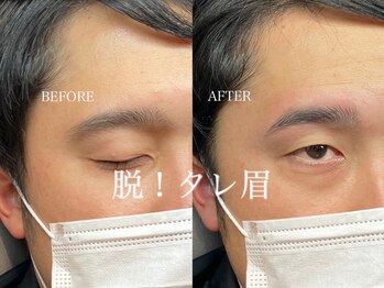 プラスアイビー 博多駅前店(+i.b)/タレ眉改善で印象up