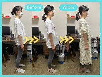 京都中丸整体カイロプラクティック/産前の反り腰