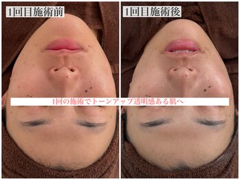 テンニック(10nick)/透明感ある肌へ