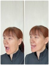 青い手/施術の流れ　2