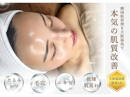 フィフ(fif)の写真