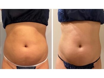 ルナグランデ(Luna grande.)/2回でここまで変わりますっ!