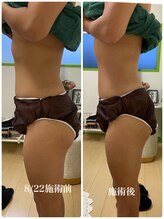 サロンドール(SalonDoll)/部分にアプローチ