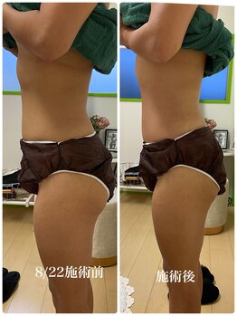 サロンドール(SalonDoll)/部分にアプローチ