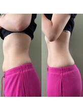 マイティー整骨院 ココア(CoCoa)/痩身マシン