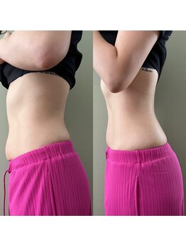 マイティー整骨院 ココア(CoCoa)/痩身マシン