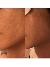 凪 横浜/肌滑らかに。